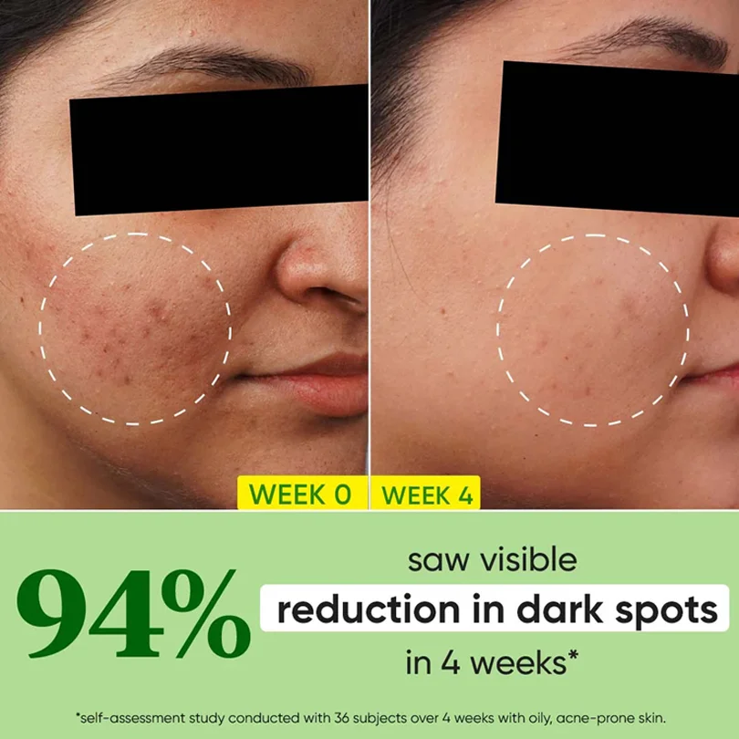 Dot & Key Cica + 10Per Niacinamide Spot Reduction Face Serum 30ml - Image 4