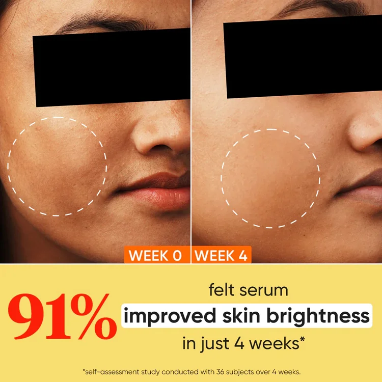 Dot Key 10Per Vitamin C E Face Serum With 5Per Niacinamide - Image 3